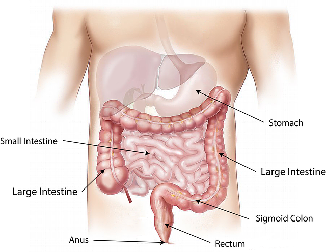 symptoms_treatment of bowel cancer